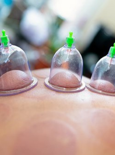cupping-therapy-01